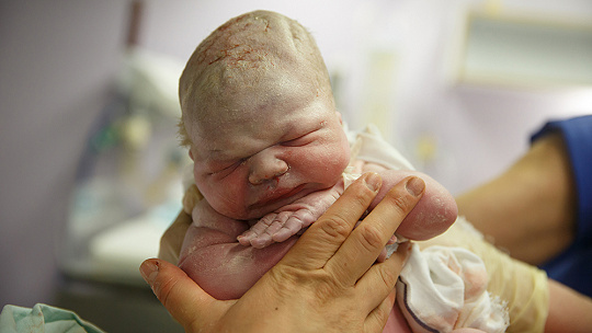 Obrázok Prečo bábätká po narodení strácajú na váhe? Je to nevyhnutné a aký úbytok je v poriadku, vysvetľuje odborník
